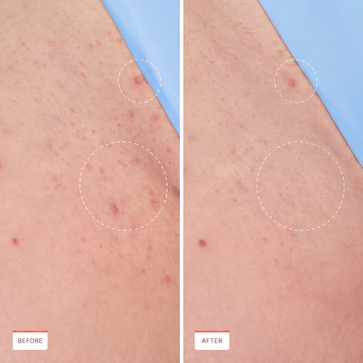 Verena Smooth Glide Serum
