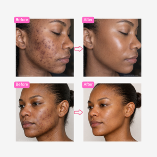 Verena™ Korean Brightening Cream